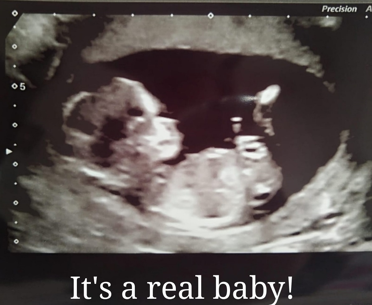 20180629 the next scan