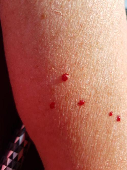 backpacking, long distance walks, walking the pilgrims way, the pilgrims way winchester to canterbury, women walking solo